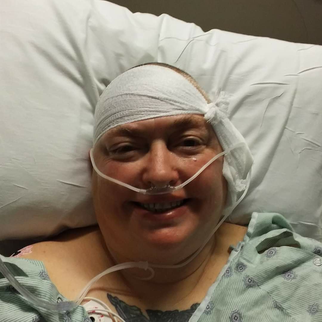 Carmel is smiling, she has had her second brain surgery. Carmel has a dressing covering her head and surrounded by various tubes.