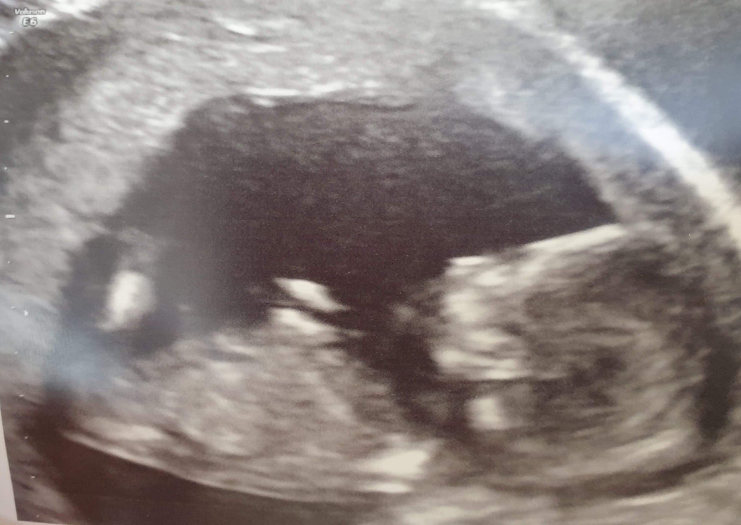 Our first scan picture of little Avenger